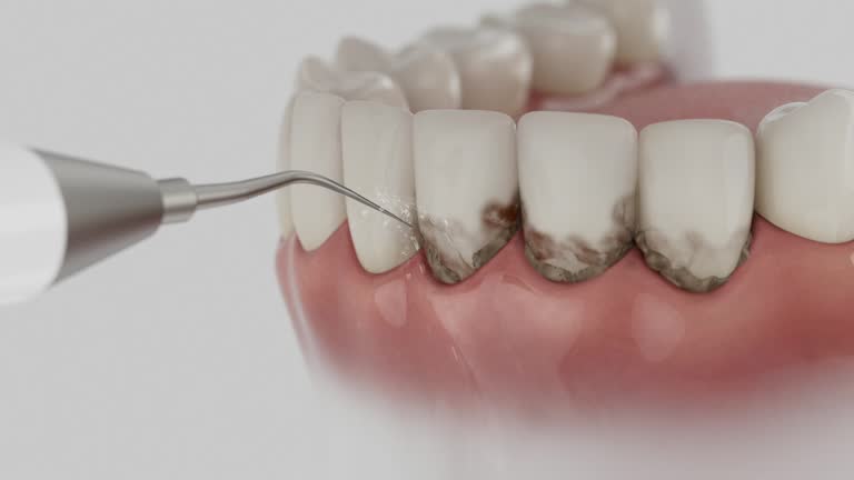 Trusted Tooth Extraction service in Timberlake, VA - Dentist Open Now